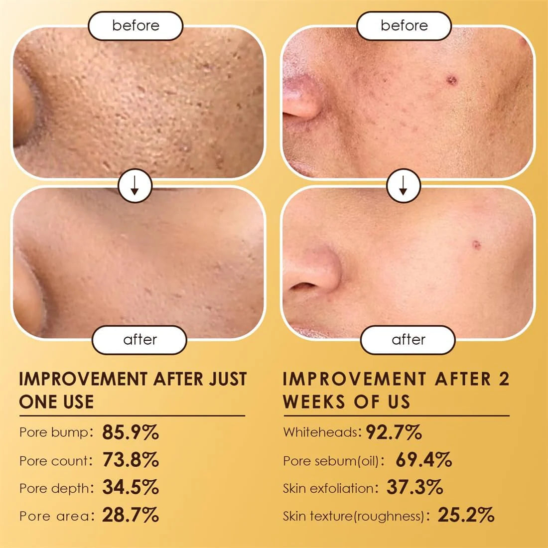 أمبولات مولينس بيل شوت بي 5 المقشرة (عبوة من قطعتين)