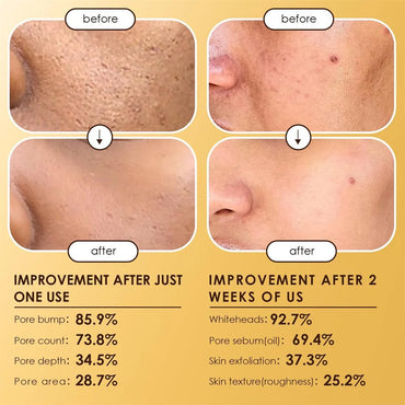 أمبولات مولينس بيل شوت بي 5 المقشرة (عبوة من قطعتين)